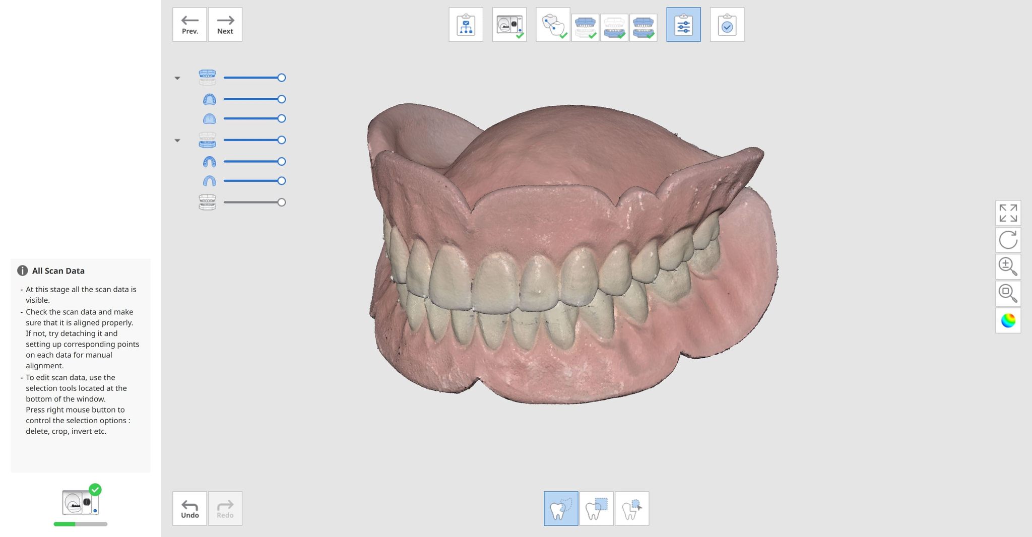 Medit Scan for Labs software — full arch view