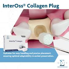 InterOss Collagen — product view 2